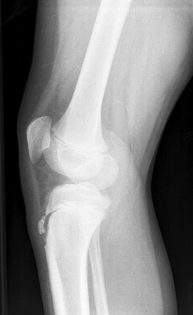 Confianza • Precisión